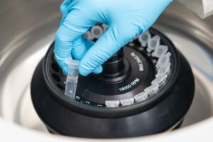 Fixing Clogged Sink Aerators